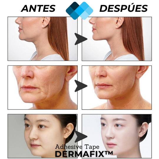 (PACK 120 Unidades) Tiras de Lifting facial efecto Natural "Buena Cara" l BeautySide™